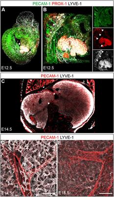 Volumetric imaging reveals VEGF-C-dependent formation of hepatic lymph vessels in mice